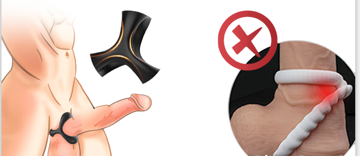 Luxury Play - LP07 - Cockring - Elastic - Stretch - 3 Part Ring - Silicone - Black