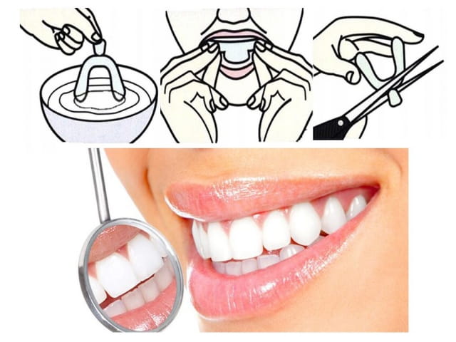 Snoring Brace 2 Pack - Clear - In plastic bag